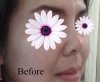 before.jpg