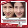 YBT_Before After_01-04.jpg