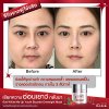 YBT_Before After_01-12.jpg
