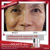 YBT_Before After_01-14.jpg YBT_Before After_01-14.jpg