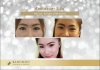 ตา2ชั้น 2.jpg