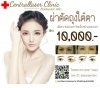 ผ่าตัดถุงใต้ตา1.jpg
