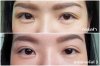 หลังทำครั้งที่ 3resize.jpg