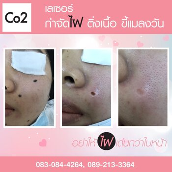 รีวิว 101_๒๐๐๓๐๔_0033.jpg