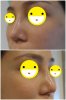 หลังทำ1.jpg