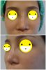 หลังทำ2.jpg