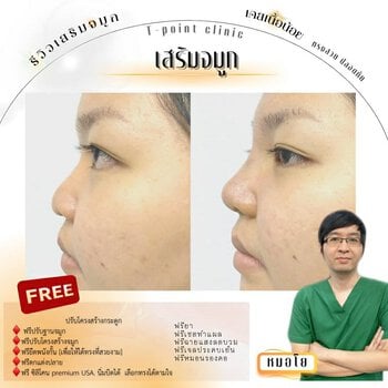 choose a clinic Rhinoplasty2.jpg