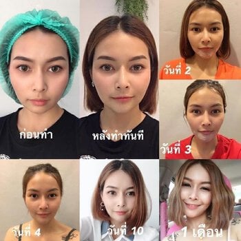 choose a clinic Rhinoplasty3.jpg