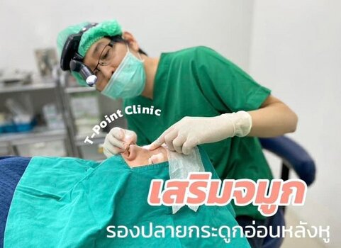 เสริมจมูกเชียงใหม่ Semi-Open 4.jpg เสริมจมูกเชียงใหม่ Semi-Open 4.jpg