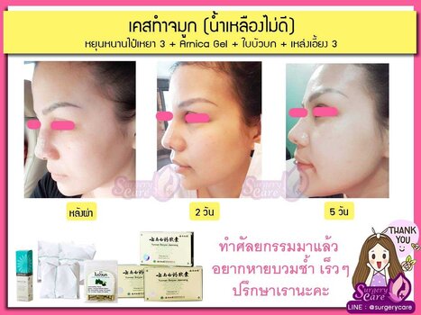 ลูกค้าน้ำเหลืองไม่ดี.jpg
