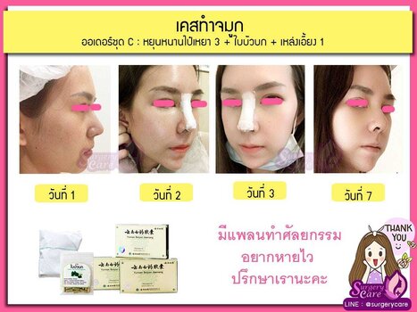 ออเดอร์ C.jpg