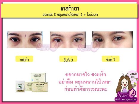 ออเดอร์A.jpg