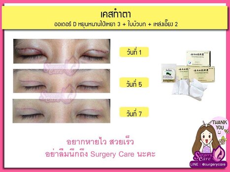 ออเดอร์D.jpg
