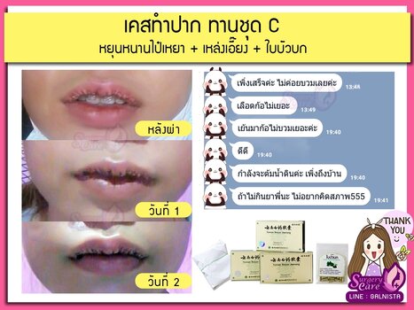 LINE_ALBUM_SURGERYCARE_๒๔๐๓๐๕_3.jpg