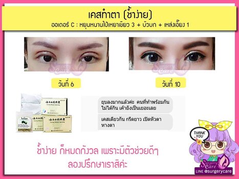 ตา ช้ำง่าย c.jpg