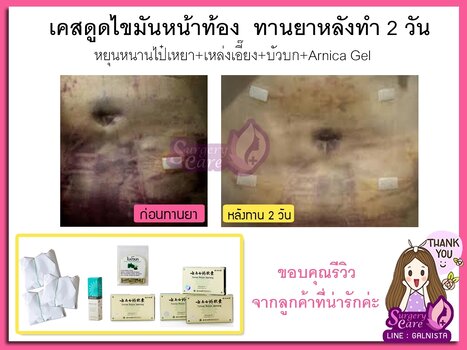 หน้าท้อง.jpg