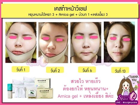 LINE_ALBUM_SURGERYCARE_๒๔๐๓๐๕_1.jpg