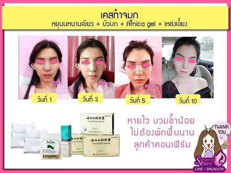 LINE_ALBUM_SURGERYCARE_๒๔๐๓๐๕_3.jpg