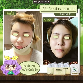 LINE_ALBUM_โครงหน้า_๒๔๐๓๐๗_1.jpg