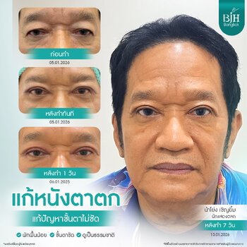 BJH Bangkok_น้าโย่ง เชิญยิ้ม_T5-1.jpg BJH Bangkok_น้าโย่ง เชิญยิ้ม_T5-1.jpg