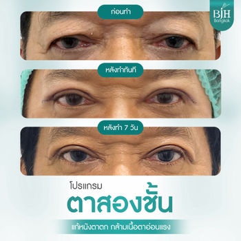 BJH Bangkok_น้าโย่ง เชิญยิ้ม_T5-2 (Small).png