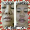 mouth1.jpg