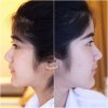mesoestetic2.jpg