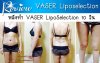 Vaser-หลังทำ10-วัน.jpg Vaser-หลังทำ10-วัน.jpg