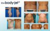 body-jet-surgical-liposuction-for-women.jpg