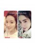 เสริมจมูก_26(1).jpg เสริมจมูก_26(1).jpg