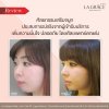 2lagraceclinic-กุมภาพันธ์2.jpg
