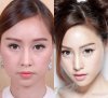 ร้อยไหม Stemcell Premuim.jpg