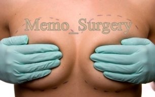 memo_surgery