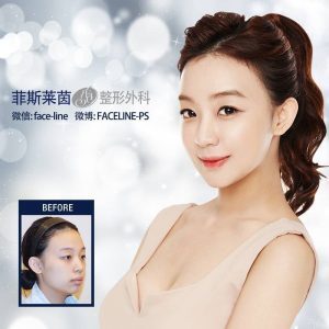 Korea Face-line Surgery and Dental Clinic