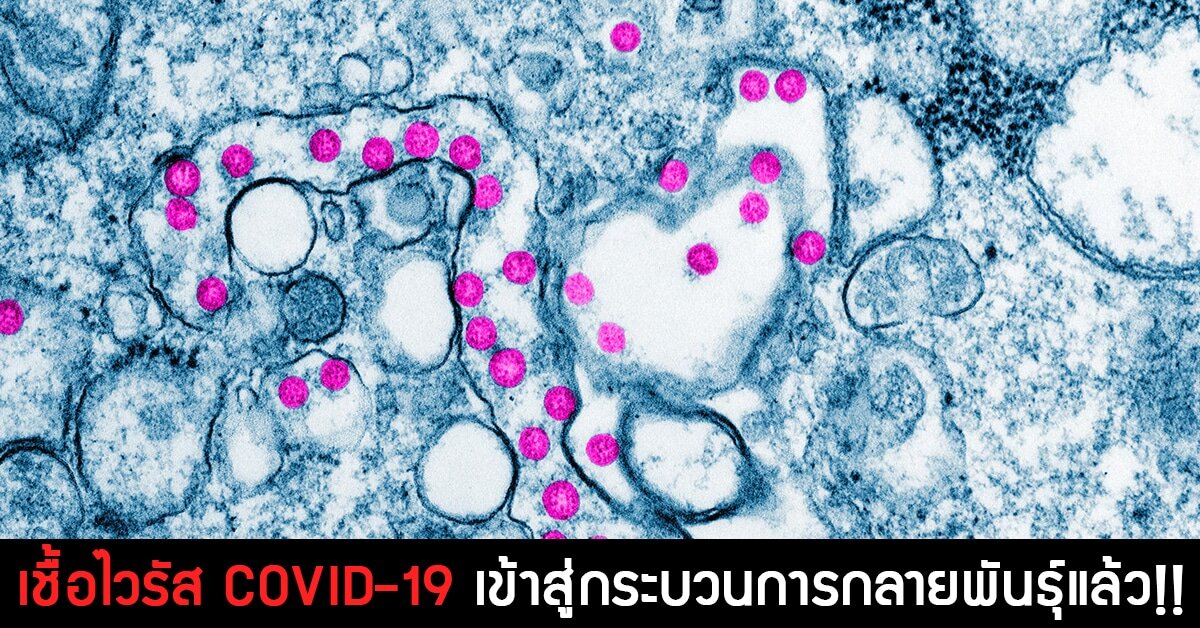 เชื้อไวรัส COVID-19