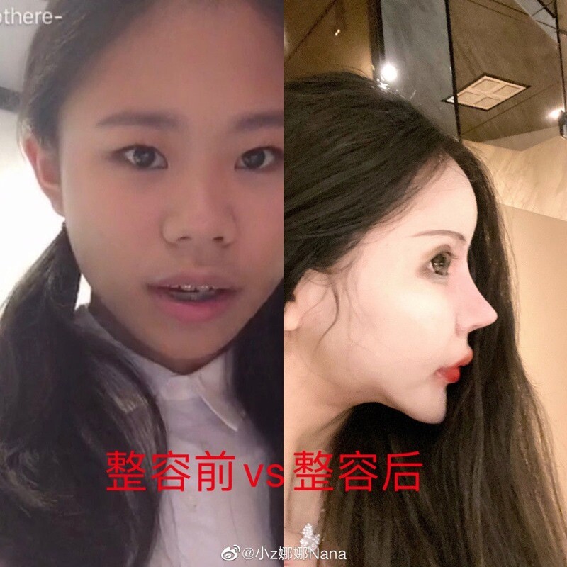 สาวจีนวัย 18
